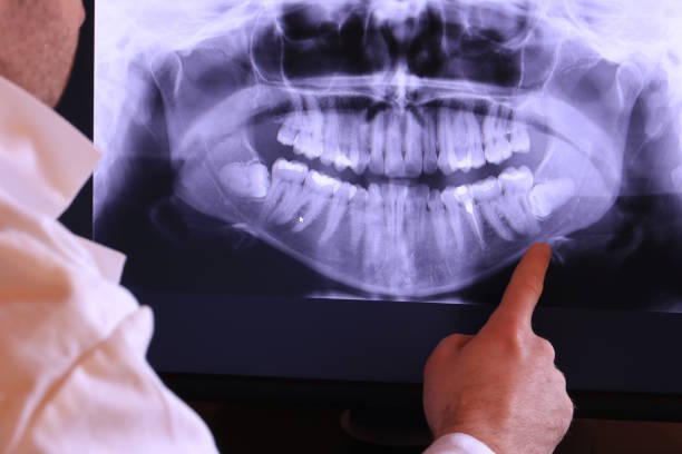 Best Emergency Wisdom Teeth Removal in Country Clu, MO
